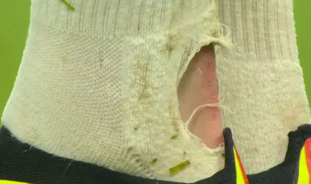 Anthony Gordon's Achilles after being tackled by Sofyan Amrabat